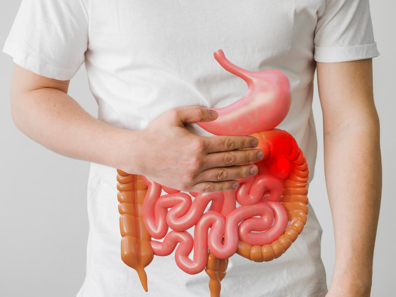 Medical Aid Plans that Cover Crohn’s Disease